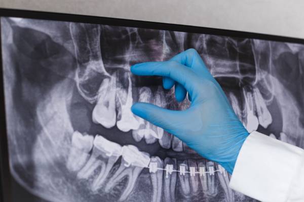 Oral Medicine and Radiology in Hinjewadi